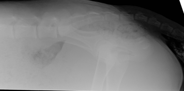 Lateral-pelvis_0003_Background-1.png