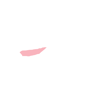 Caudal Vena Cava