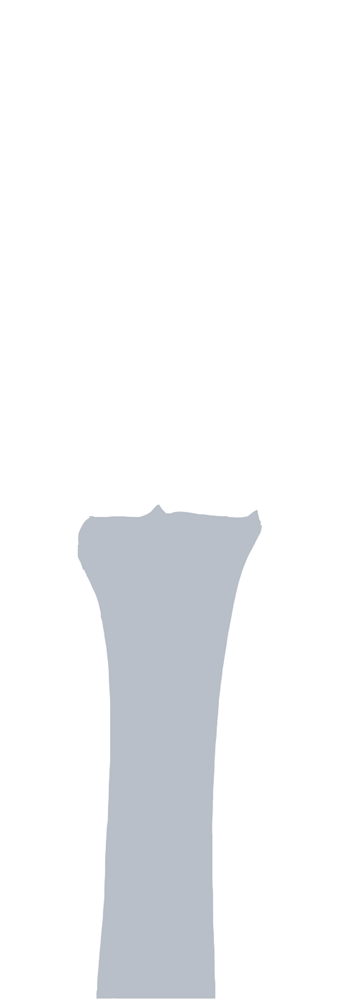 Metacarpal 3 and 4