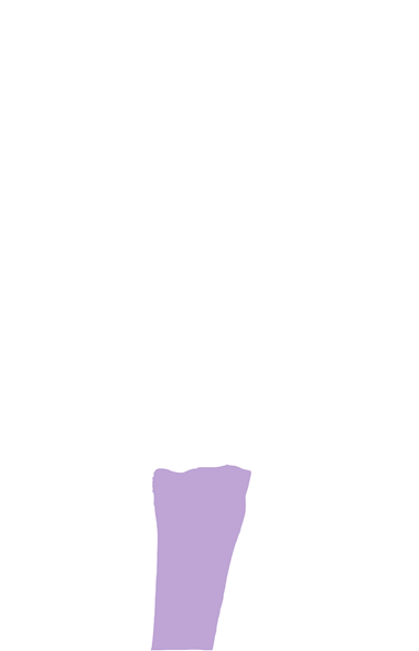 Metarsal 3 and 4