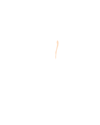 Unfused Metacarpal 5