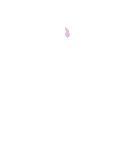 Ulnar Carpal Bone