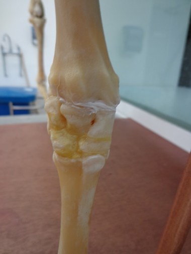 Skeleton Image
